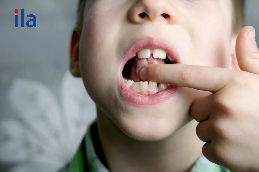 Các nguyên nhân phổ biến dẫn đến việc phát âm không chuẩn ở trẻ.