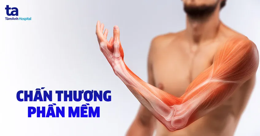 Hình ảnh minh họa chấn thương phần mềm