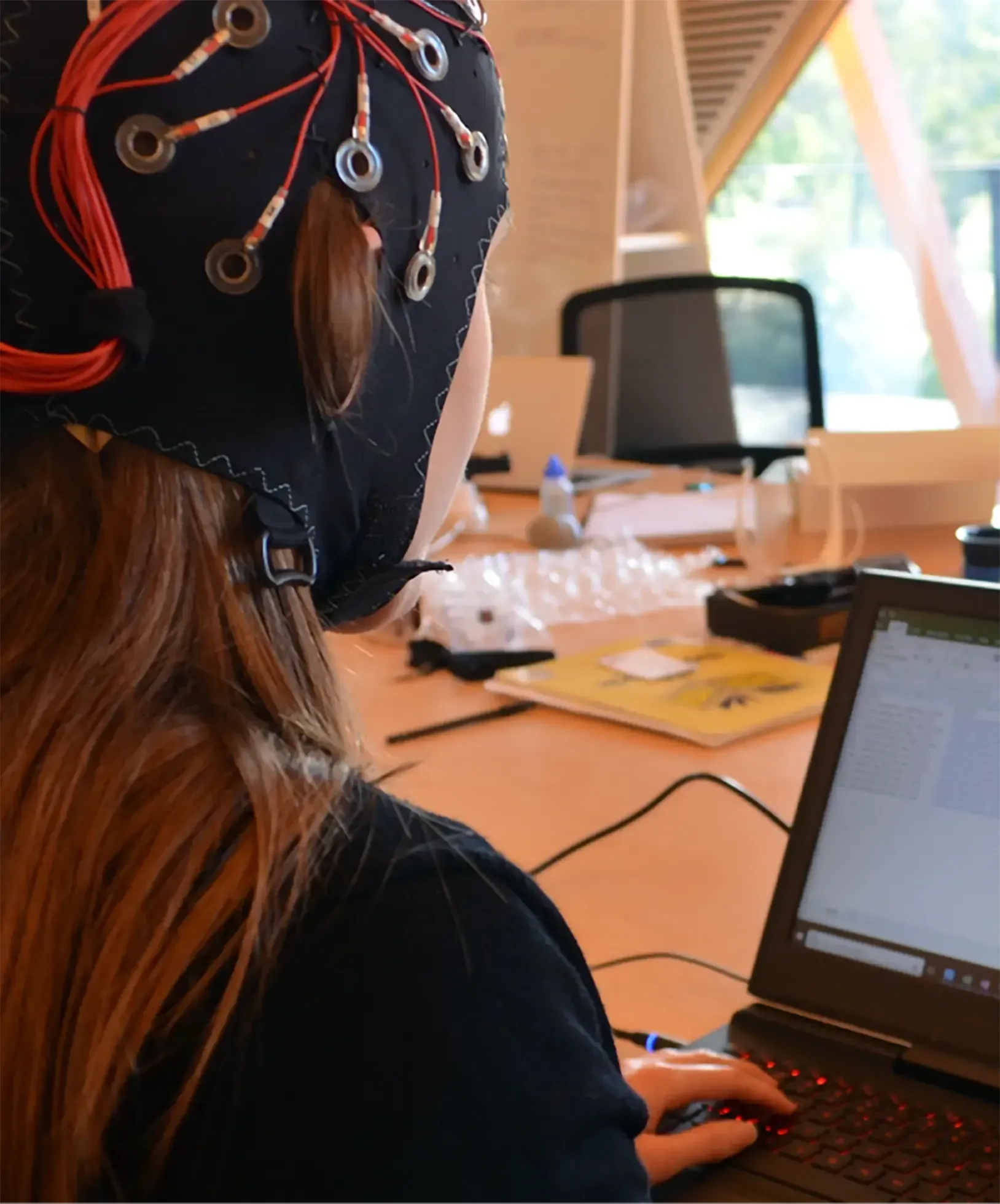 Kết quả nghiên cứu dịch sóng não tại Đại học Xi’an