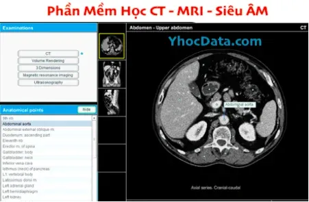 Ảnh chụp màn hình phần mềm Atlas of Anatomy khi sử dụng